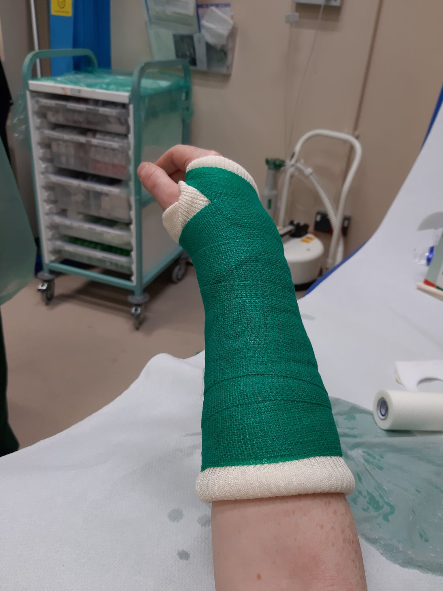 Soft Cast – The Broken Bone Club